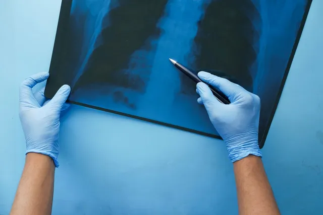 Pacemaker insertion