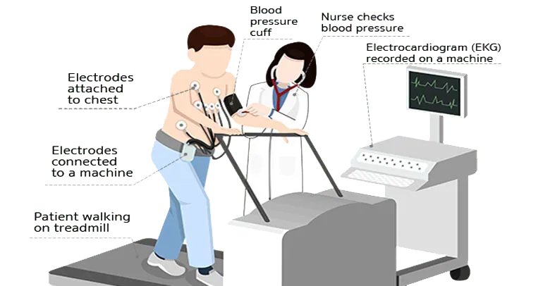 Treadmill test
